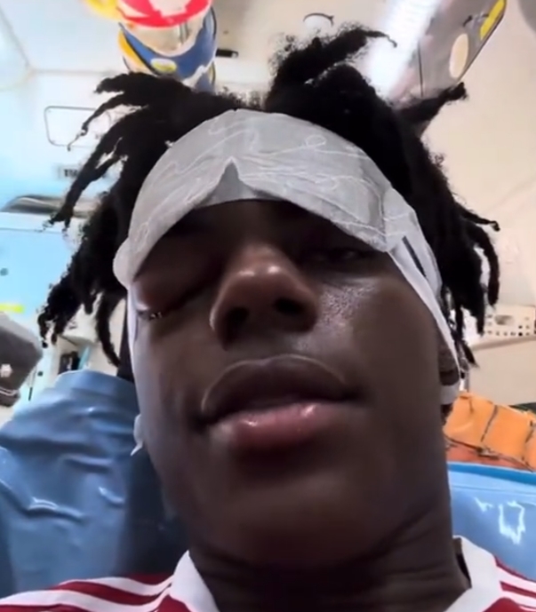 IShowSpeed'e ne oldu? Speed'in hastalığı cluster headache nedir?