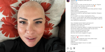 Işın Karaca, uzun zamandır taşıdığı hastalığı bu fotoğrafla paylaştı: Saklamak artık zor gelmeye başladı