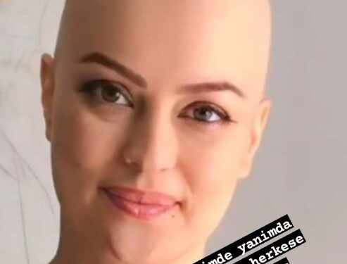 Kanser tedavisi gören oyuncu Ayçin Tuyun, peruksuz fotoğrafını paylaştı