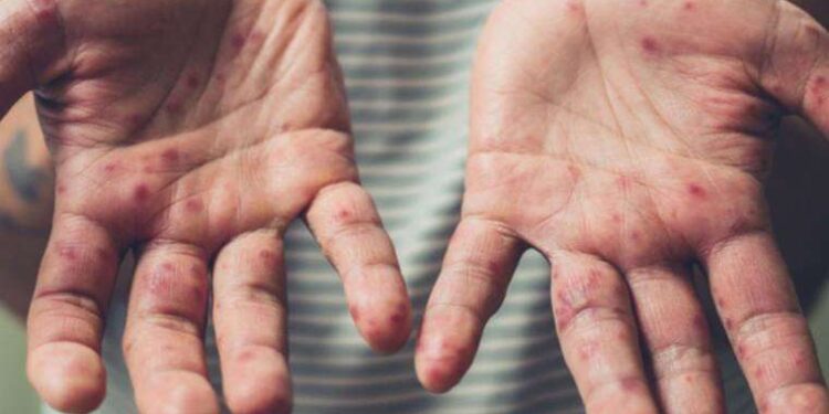 Fahrettin Koca, ‘HPV aşısı ücretsiz olacak’ demişti: Aşıdan haber yok!