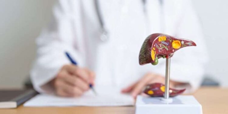 Uzmanlardan kritik uyarı: ‘Siroz tedavisi kişiye özeldir, ihmal edilmemelidir’