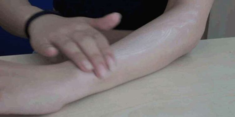 Uzmanı uyardı: Güneş yanıklarına evde tedavi uygulanmamalı