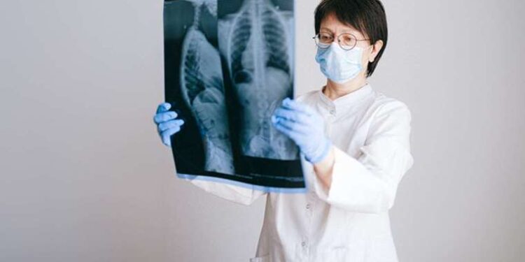 Meme kanseri teşhisinde radyologlara destek olacak yapay zekâ geliştirildi