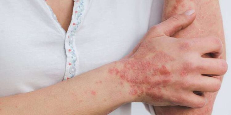 TV yayın akışı 26 Ağustos Cumartesi! Hangi kanalda ne var, günün filmleri ve dizileri neler?