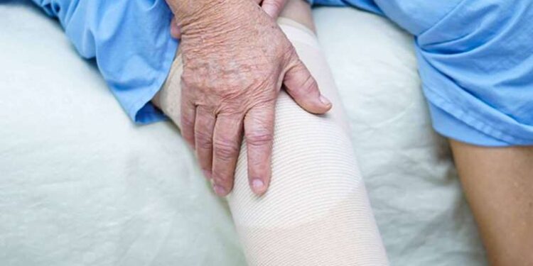 Diz protezi sonrası rehabilitasyon iyileşmede hayati önem taşıyor!