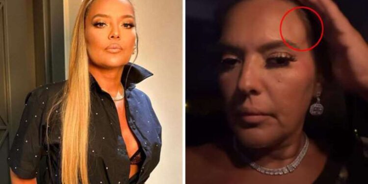 Saniyelerle kurtuldular… Demet Akalın ‘tekne kazası’ geçirdi: ‘Nasıl sağ çıktık algılayamıyorum’