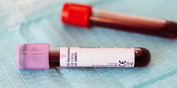 Genetik testlerin önemi: Pıhtılaşma ve inme vakalarında erken teşhis sağlıyor