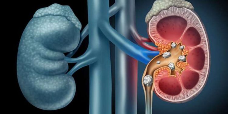Sarayini: Roma döneminin lüks ve imkanlarla dolu yeraltı sırrı