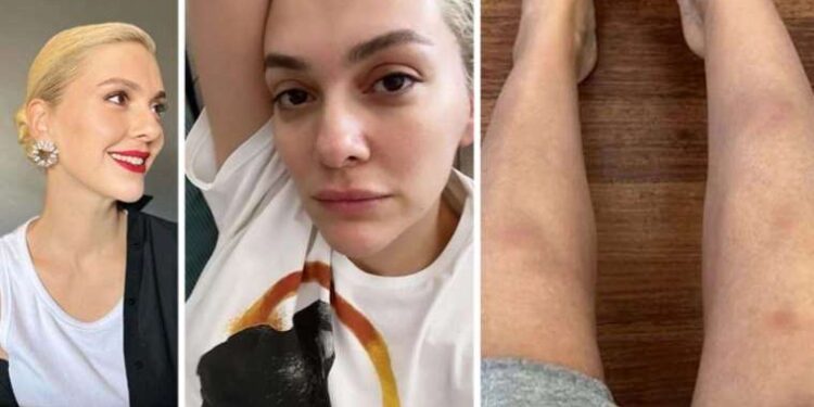 Bergüzar Korel’in ‘oyunculuğun zorluklarını’ anlattığı paylaşım sosyal medyayı ikiye böldü: ‘Duyan da asgari ücrete çalışıyor sanır!’