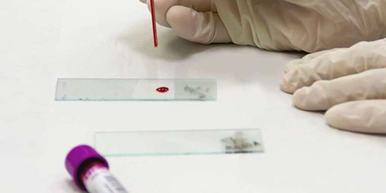 Bağışıklık sistemini doğrudan etkileyen ‘monosit’ nedir?