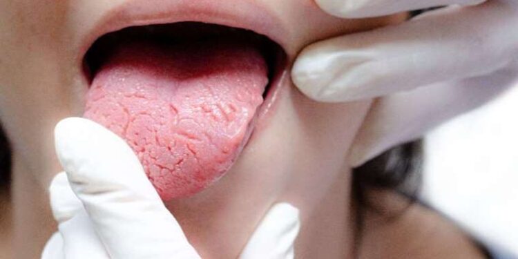 Dilinizi çıkarın ve rengine bakın! Diliniz bu renkse kalbiniz yeterli çalışmıyor olabilir…