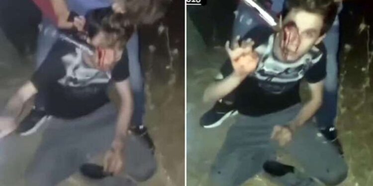 Diyaframı yırtılan kedi, hastaneye gidip ameliyat oldu; İşte o anlar…