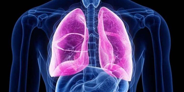 Asbest maruziyetinin yol açtığı hastalık: Mezotelyoma