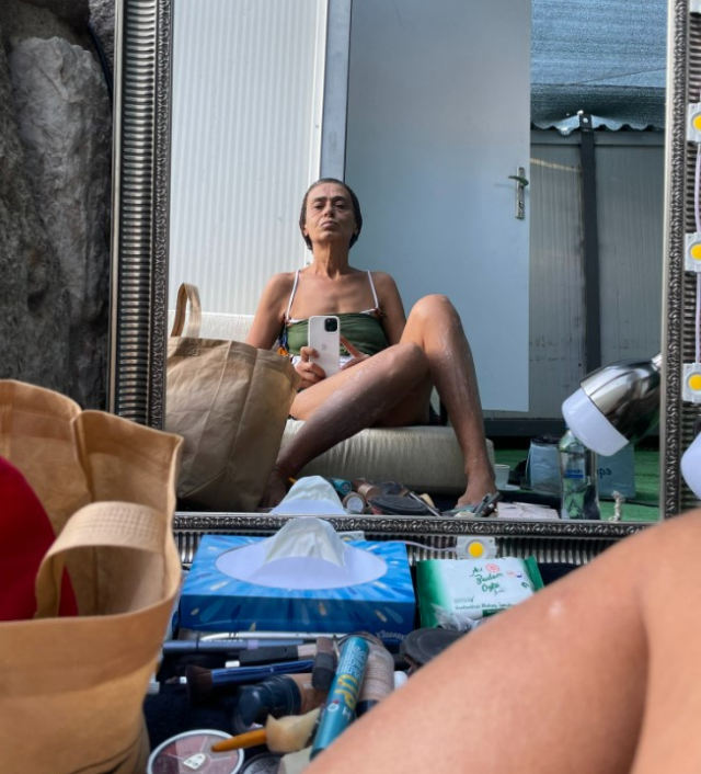 mini-etekli-pozlarini-paylasan-yildiz-tilbe-nin-16205490_5445_m Mini etekli pozlarını paylaşan Yıldız Tilbe'nin bacaklarındaki lekeler sevenlerini korkuttu