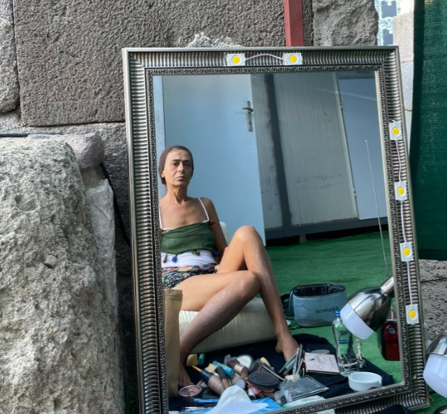 mini-etekli-pozlarini-paylasan-yildiz-tilbe-nin-16205490_7732_m Mini etekli pozlarını paylaşan Yıldız Tilbe'nin bacaklarındaki lekeler sevenlerini korkuttu