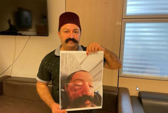 Sosyal medya fenomeni, ev sahibi tarafından darp edildi: Öyle bir vurdu ki kendime gelemedim