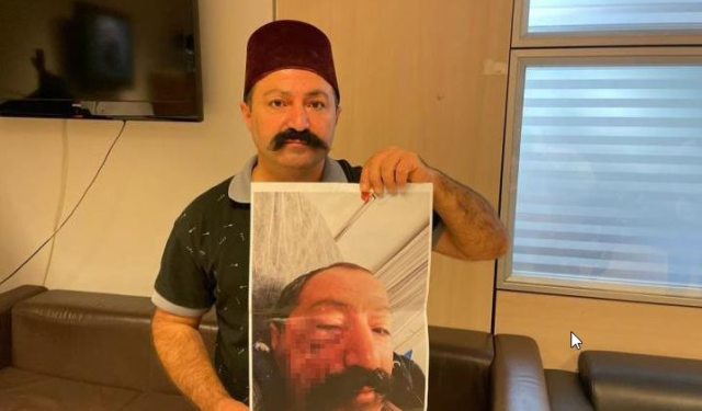 Sosyal medya fenomeni, ev sahibi tarafından darp edildi: Öyle bir vurdu ki kendime gelemedim