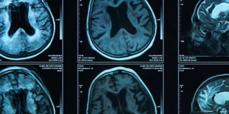 İngiliz komedyen ve aktör Russell Brand’e tecavüz suçlaması