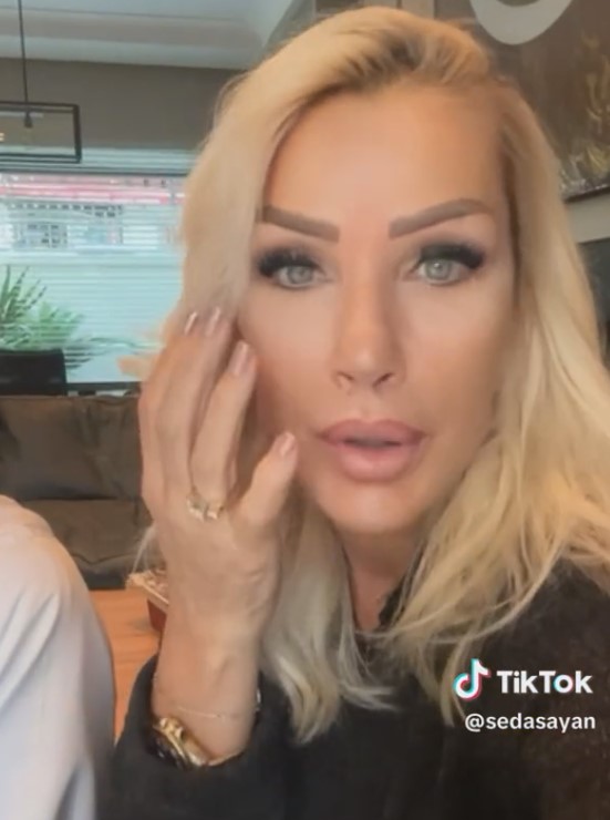 seda-sayan-genc-gorunmek-icin-yuzune-sunnet-16560122_4761_m-1 Seda Sayan genç görünmek için yüzüne sünnet derisinden elde edilen sıvıyı enjekte ettirdi