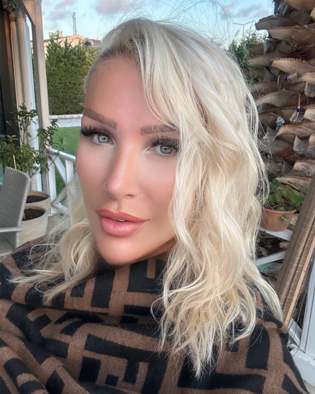 seda-sayan-genc-gorunmek-icin-yuzune-sunnet-16560123_2451_m Seda Sayan genç görünmek için yüzüne sünnet derisinden elde edilen sıvıyı enjekte ettirdi