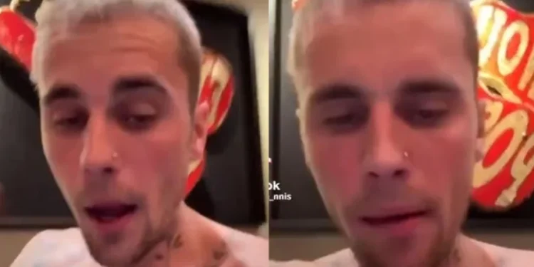Justin Bieber'ın Son Hali Hayranlarını Endişelendirdi