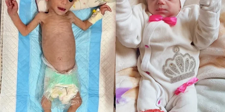 Gazze'de 5 Aylık Suvar Aşur, Yetersiz Beslenme Tehlikesiyle Karşı Karşıya