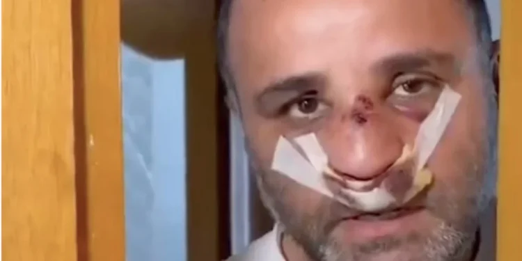 Marmaray’da Çocukları Önünde Saldırıya Uğrayan Baba Anlattı