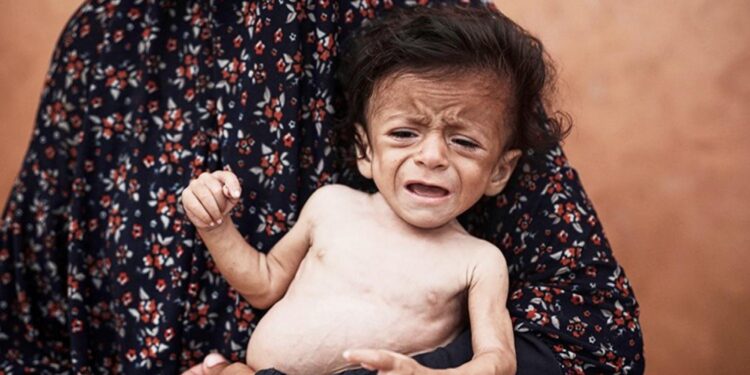 5 aylık Ammar açlıktan ölmek üzere