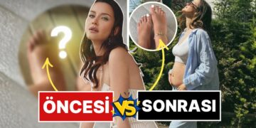 7 Aylık Hamile İrem Helvacıoğlu Hamilelikte Ödemden Kocaman Olan Ayaklarının Çaresini Bakın Ne ile Buldu?