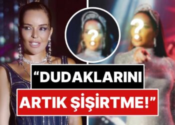 “Bari Sen Yapma N’olur”: Ünlü Şarkıcı Bengü Son Pozlarında Şiştikçe Şişen Dudağıyla Dikkat Çekti!