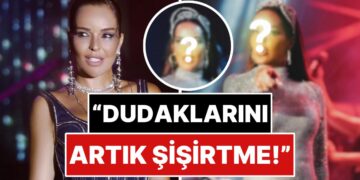 “Bari Sen Yapma N’olur”: Ünlü Şarkıcı Bengü Son Pozlarında Şiştikçe Şişen Dudağıyla Dikkat Çekti!