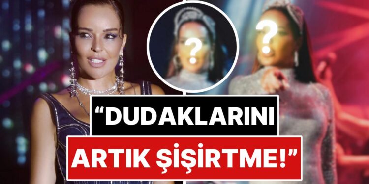 “Bari Sen Yapma N’olur”: Ünlü Şarkıcı Bengü Son Pozlarında Şiştikçe Şişen Dudağıyla Dikkat Çekti!