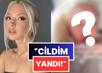 Biraz Fazla Olmamış mı? Ece Seçkin Rengini Açtığı Kaşlarının Son Halini Takipçileriyle Paylaştı!