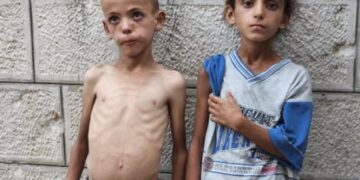 DSÖ: Gazze’de daha fazla çocuk risk altında