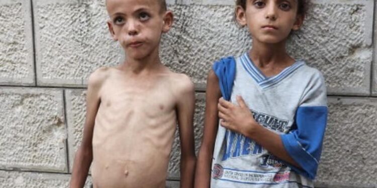 DSÖ: Gazze’de daha fazla çocuk risk altında