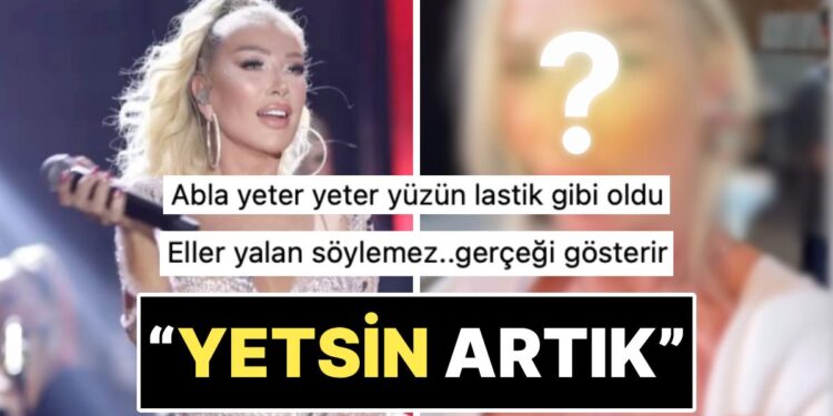 “Eller Yalan Söylemez”: Yeni Yaptırdığı Estetikle Yüzünün Kalktığına İnanan Seda Sayan Son Halini Paylaştı!