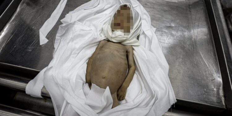 Gazze’de açlık nedeniyle ölenlerin sayısı 201’e yükseldi