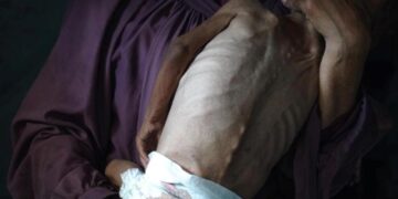 Gazze’de açlıktan 5 ölüm daha!