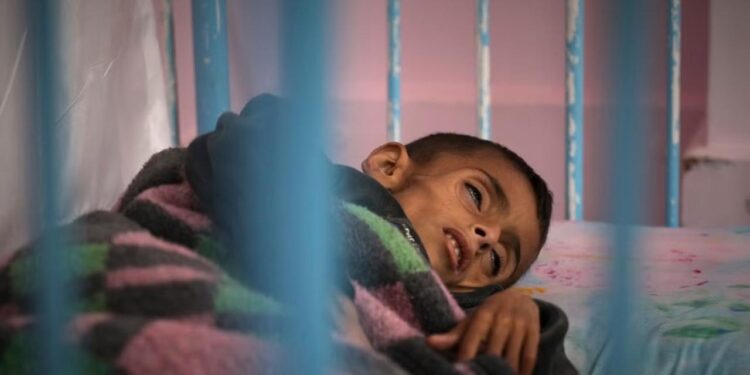 Gazze’de açlıktan vefat edenlerin sayısı 197’ye çıktı