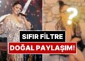 Güzellik Algılarına Rest Çekti: Bir Dönem Yüzündeki İzlerle Çok Konuşulan İzel’den Filtresiz Paylaşım!