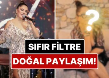 Güzellik Algılarına Rest Çekti: Bir Dönem Yüzündeki İzlerle Çok Konuşulan İzel’den Filtresiz Paylaşım!