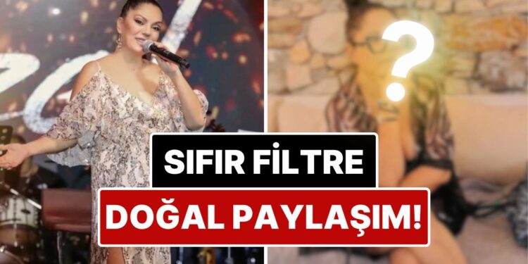 Güzellik Algılarına Rest Çekti: Bir Dönem Yüzündeki İzlerle Çok Konuşulan İzel’den Filtresiz Paylaşım!