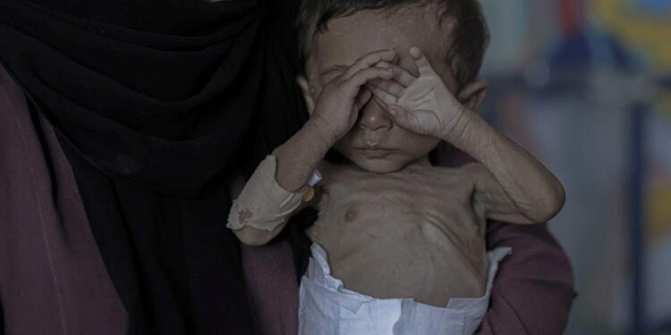 İnsanlık Gazze’de sınıfta kaldı! Açlıktan ölenlerin yarısından fazlası çocuk!