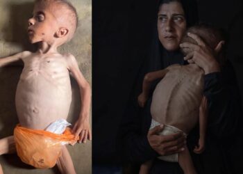 İsrail’in açlık silahı… Gazze’de 40 binden fazla bebek ölüm riskiyle karşı karşıya