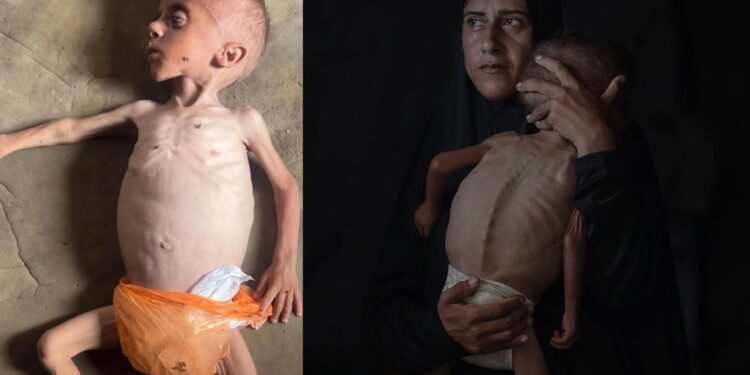 İsrail’in açlık silahı… Gazze’de 40 binden fazla bebek ölüm riskiyle karşı karşıya