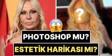 Yüzündeki Dolguları Eritip Kendini Baştan Yaratan 70 Yaşındaki Donatella Versace’nin Son Hali Şoka Soktu!