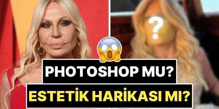 Yüzündeki Dolguları Eritip Kendini Baştan Yaratan 70 Yaşındaki Donatella Versace’nin Son Hali Şoka Soktu!
