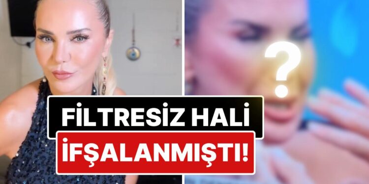 Canlı Yayında Yüzünün Filtresiz Hali İfşalanınca Gündem Olan Ece Erken’den Akıllara Durgunluk Veren Açıklama!