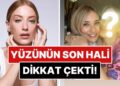 Estetik mi Yaptırdı? Bir Güzellik Merkezinden Paylaşım Yapan Hazal Kaya’nın Yüzündeki Değişim Dikkat Çekti!