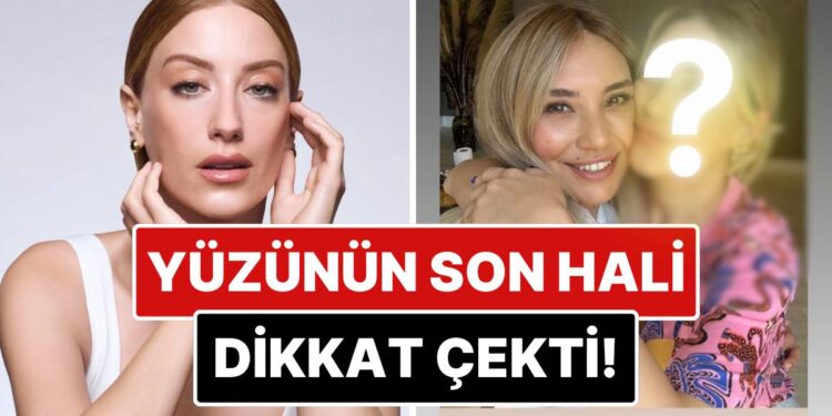 Estetik mi Yaptırdı? Bir Güzellik Merkezinden Paylaşım Yapan Hazal Kaya’nın Yüzündeki Değişim Dikkat Çekti!